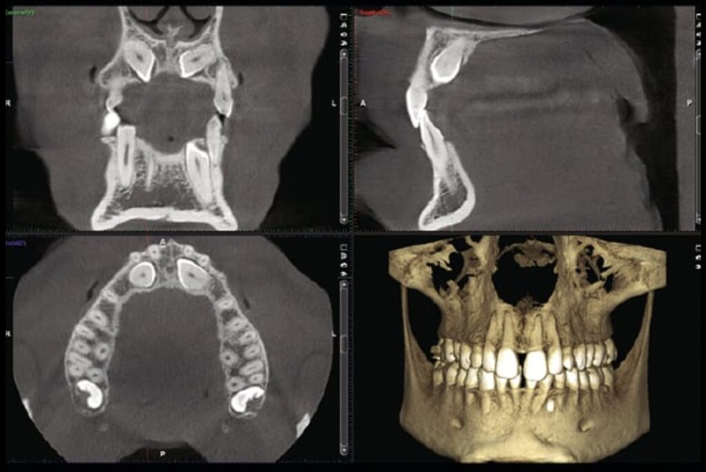 CBCT dal Dentista a Torino: Quando Serve Davvero