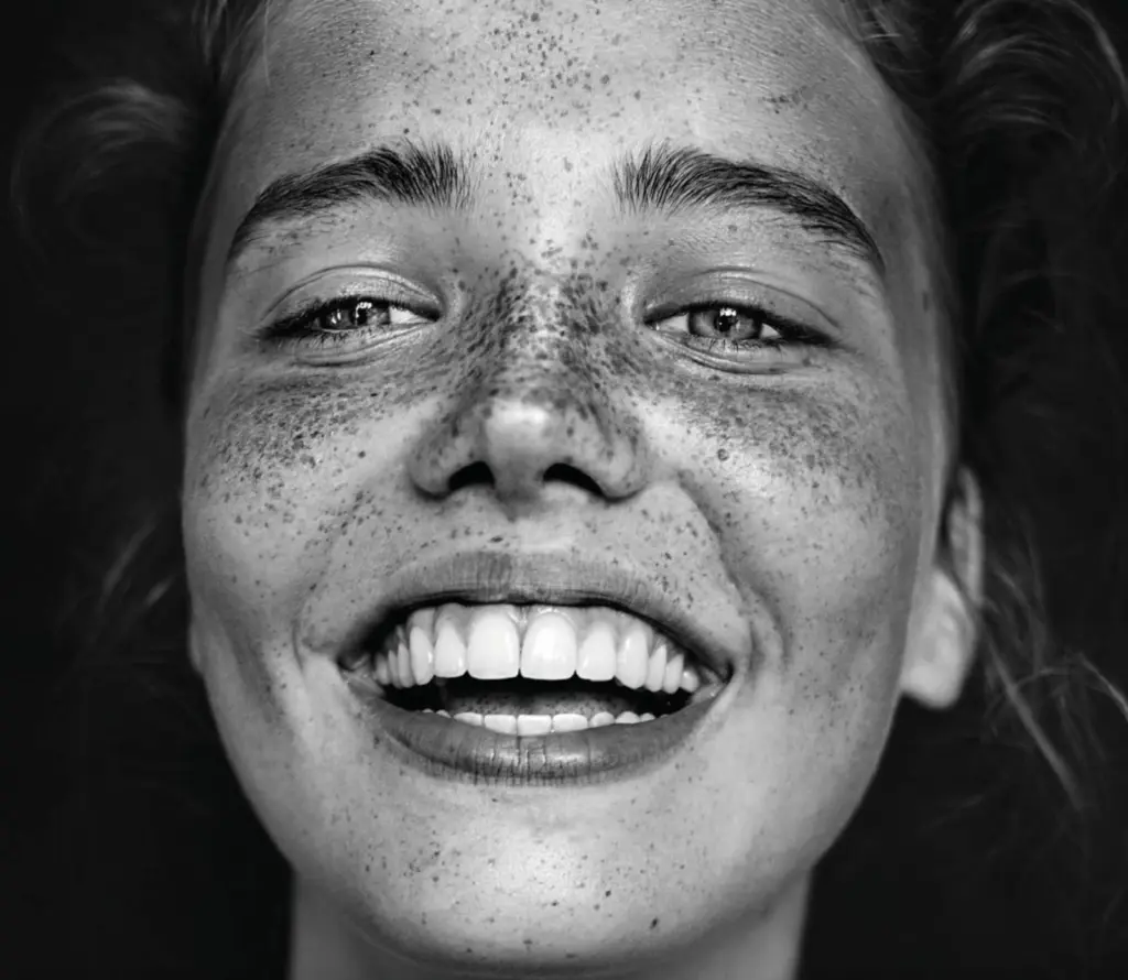 Invisalign Adultes à Turin : délais, limites et avantages