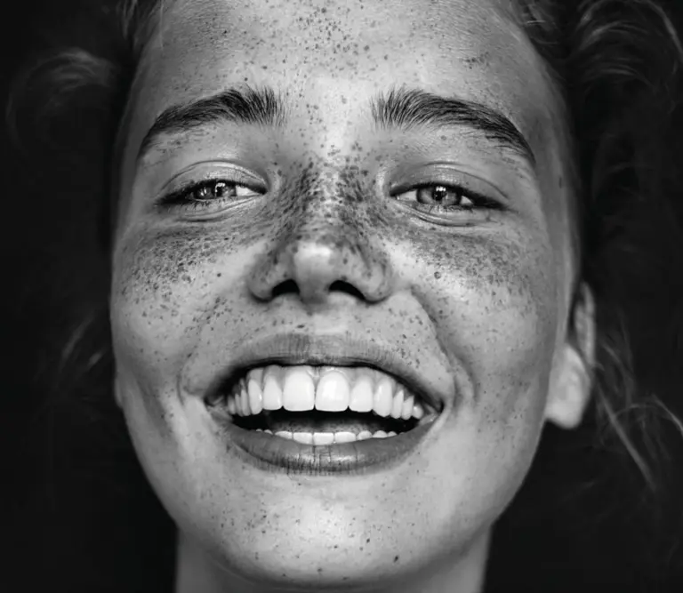 Invisalign Adulti a Torino: Tempi, Limiti e Vantaggi