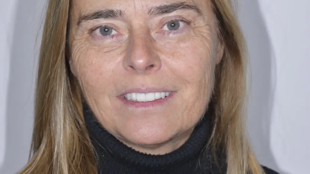 Faccette o corone sui denti anteriori: i criteri per scegliere
