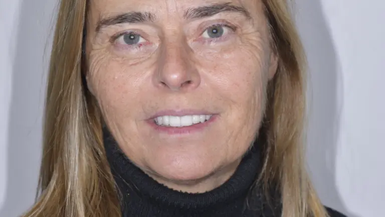 Faccette o corone sui denti anteriori: i criteri per scegliere