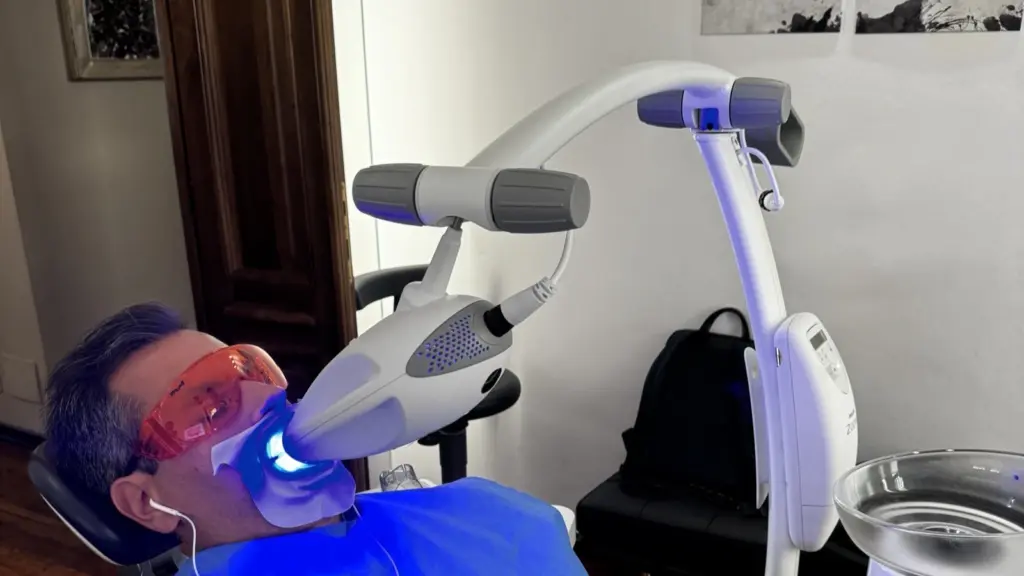 Sbiancamento dentale professionale a Torino: come funziona, sicurezza e durata