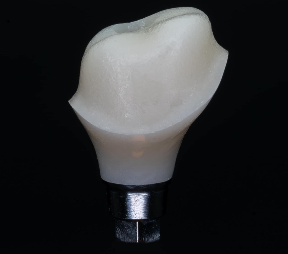 Dental implant model with a prosthetic crown